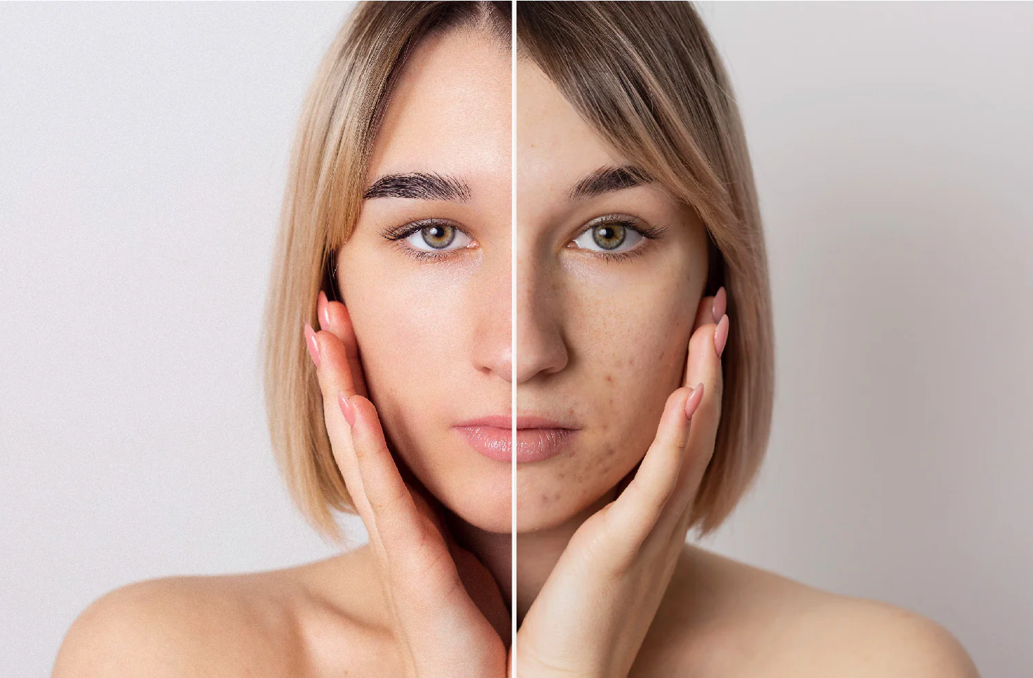 شنو هو الكلف و شنو اسبابه وشنو الحلول